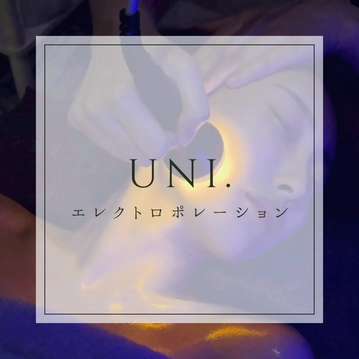 エレクトロポレーションについてご紹介します✨