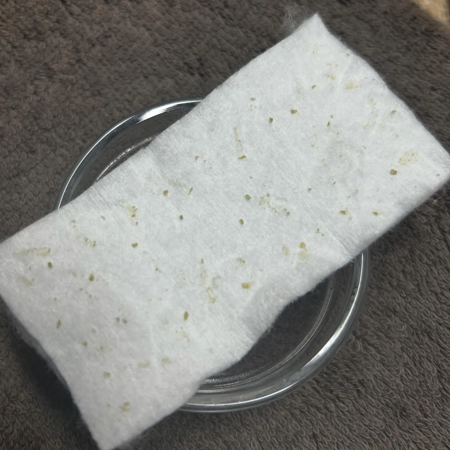毛穴エクストラクション症例⭐️