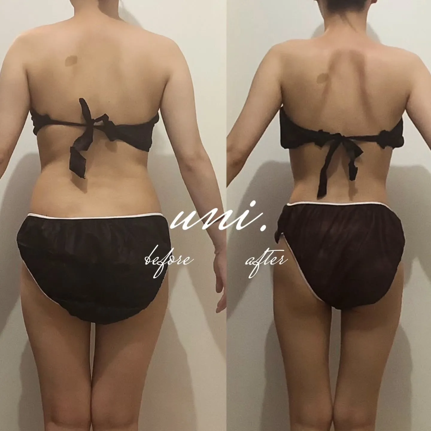 💎オーダーメイド痩身💎