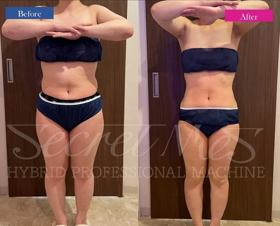 ＼寝てるだけでボディメイク✨／