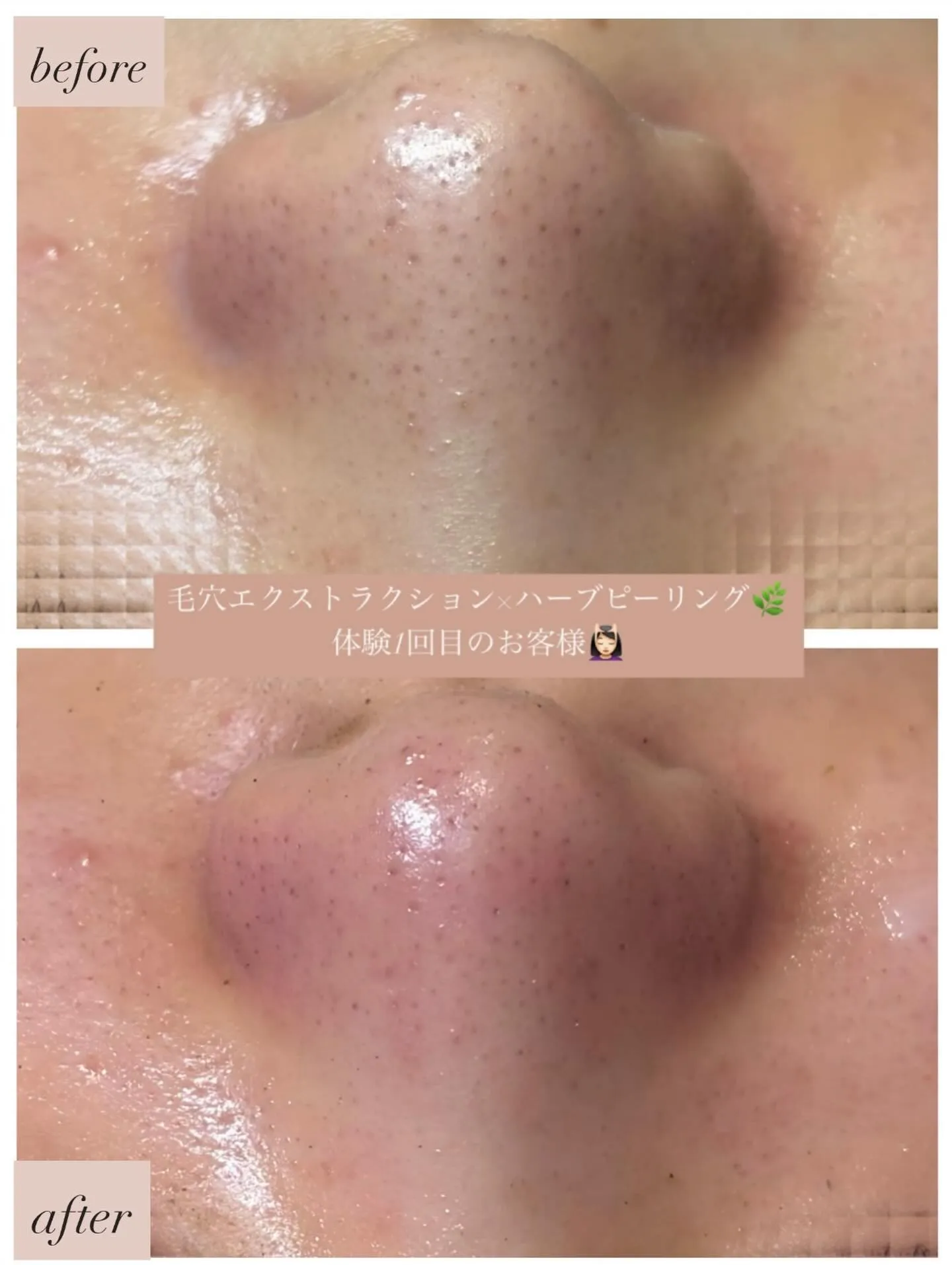 毛穴の中をきれいにする