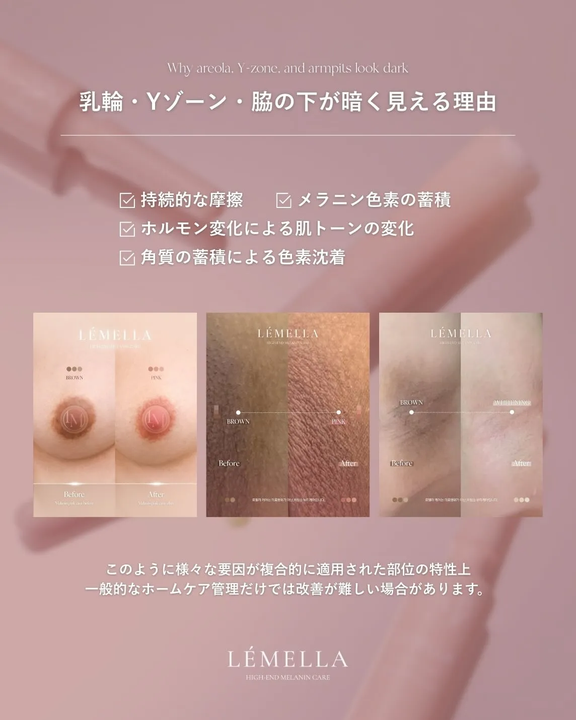 ルメラが選ばれる理由🎀🩷