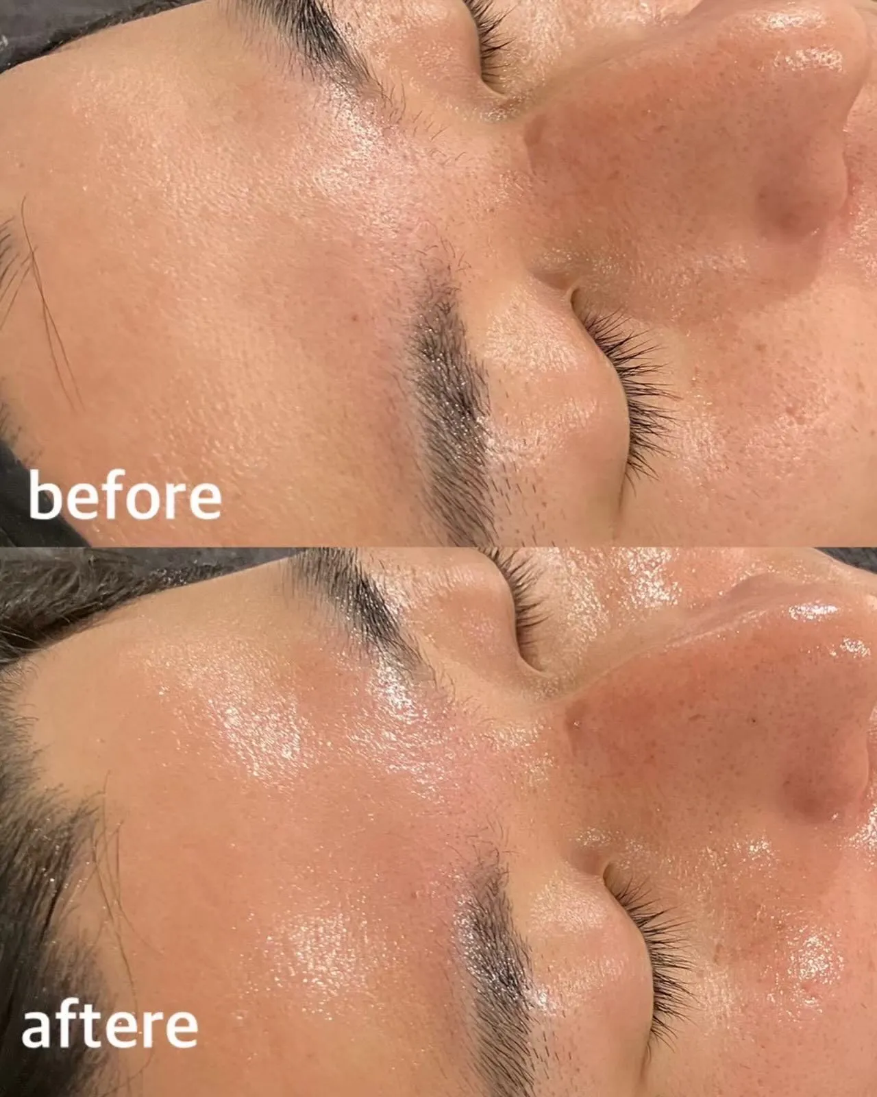 肌に“入れ込む”新発想美容。