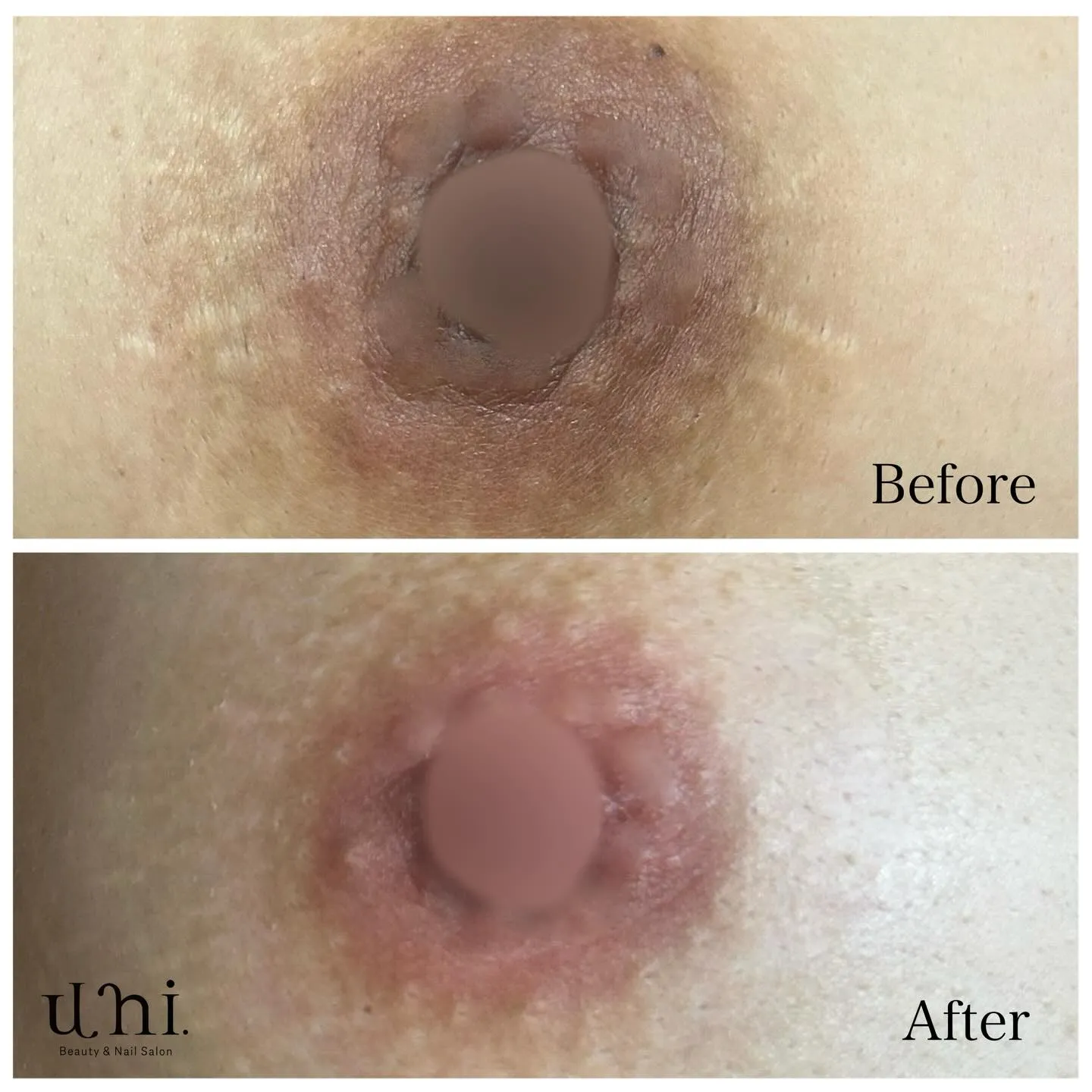 ルメラの症例をご紹介🎀🤍