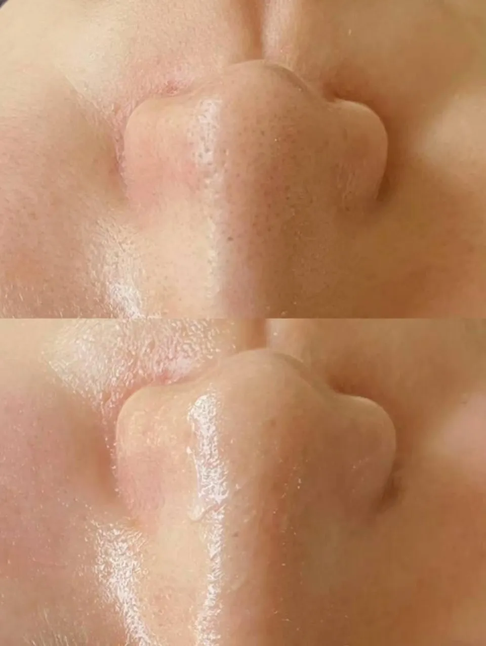 肌に“入れ込む”新発想美容💉✨