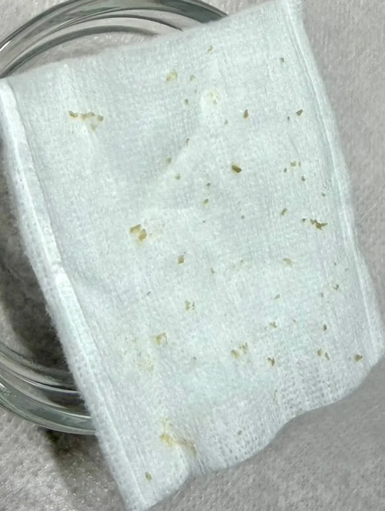 毛穴エクストラクション症例🍓