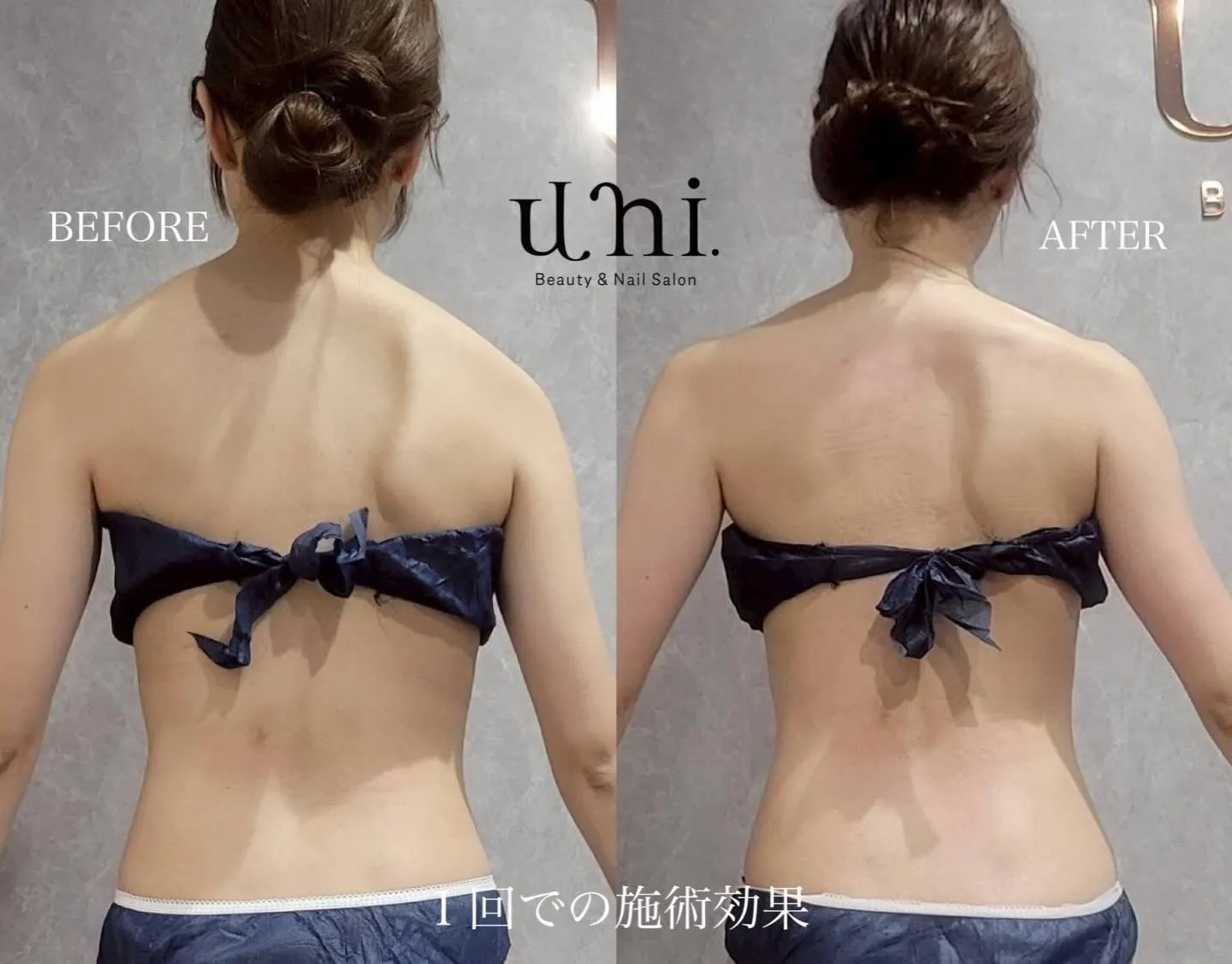 ブライダル前の背中ケア🕊️🤍