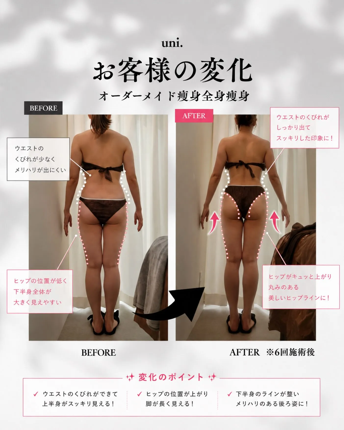 \ 6回でここまで変化✨後ろ姿美人へ /