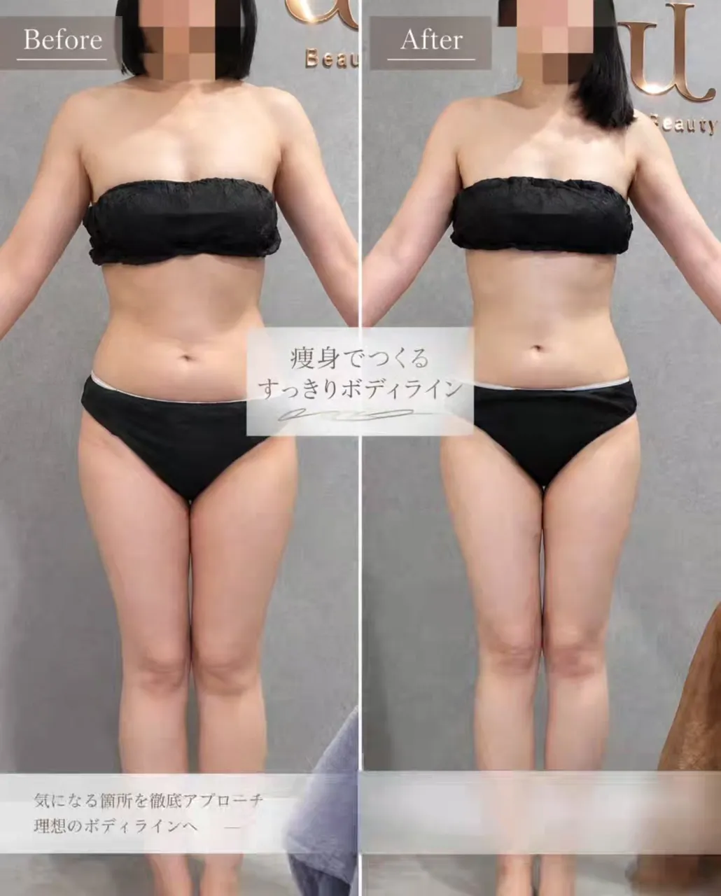 【痩身症例】